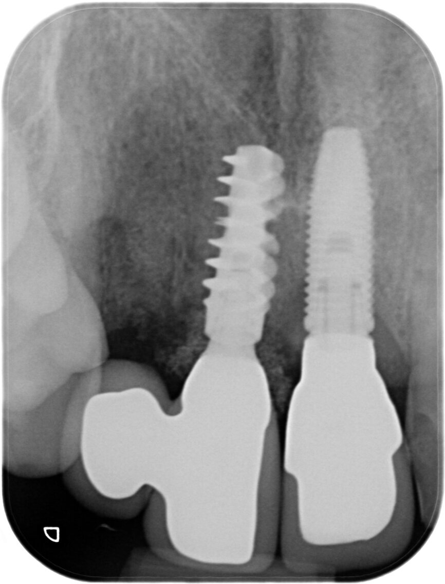 Fig 24b