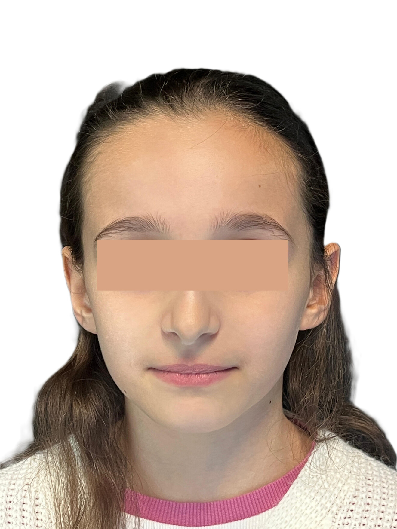 Fig. 2b