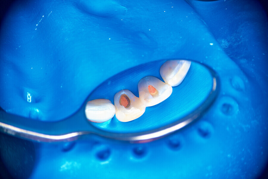Fig. 6e.