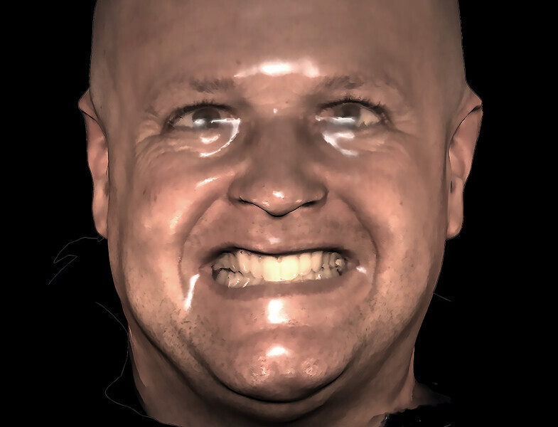 Fig. 15a: Facial scan for smile evaluation and midline assessment.