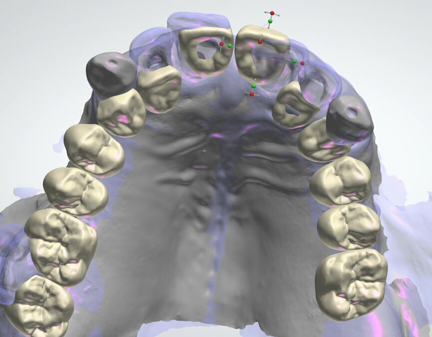 Fig. 16