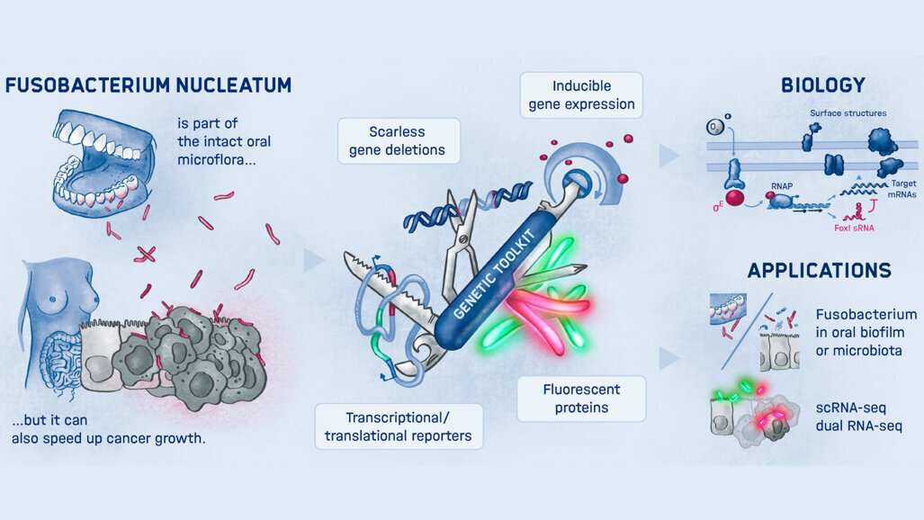 Warum der Mundhöhlenkeim Fusobacterium nucleatum Tumoren besiedelt