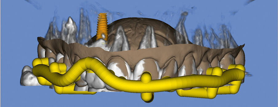 Fig. 5. DVT data set in the software program