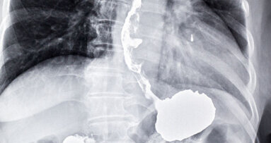 New breath test diagnoses oesophageal and gastric cancer