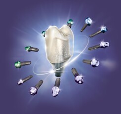 exocad – DentalCAD