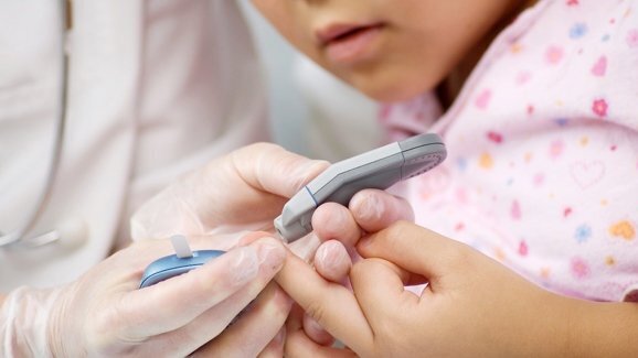 Crianças com diabetes tipo 2 mais propensos a má saúde oral