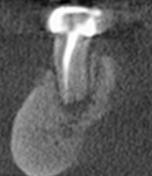 Fig. 11d