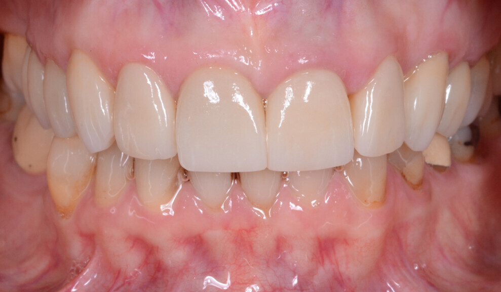 Fig. 20: Treatment outcome