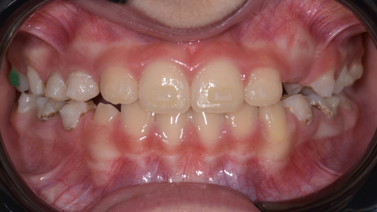 Fig. 2e