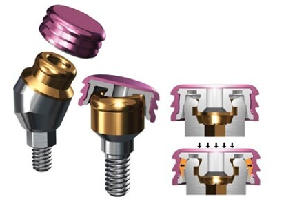 GPS abutments for overdentures