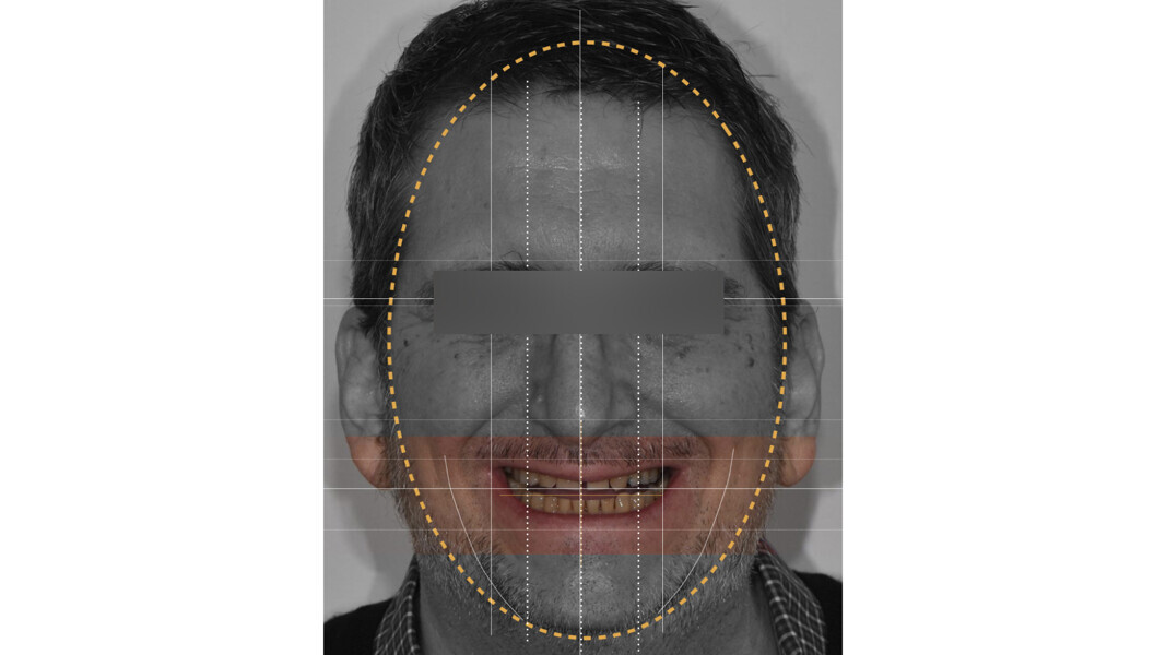 Fig. 13