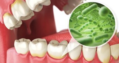 Limiter le contact champignons-bactéries peut réduire les caries chez les enfants