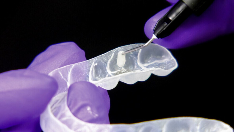 Fig. 1: Dispensing a flowable composite into an attachment template. 