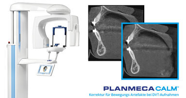 Hervorragende Bildgebung mit DVT-Geräten von Planmeca