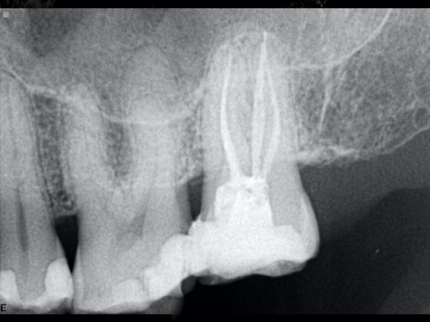Fig. 10
