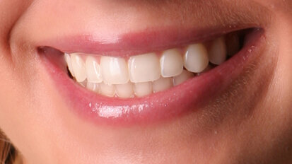 Dental school researchers isolate steps in enamel formation