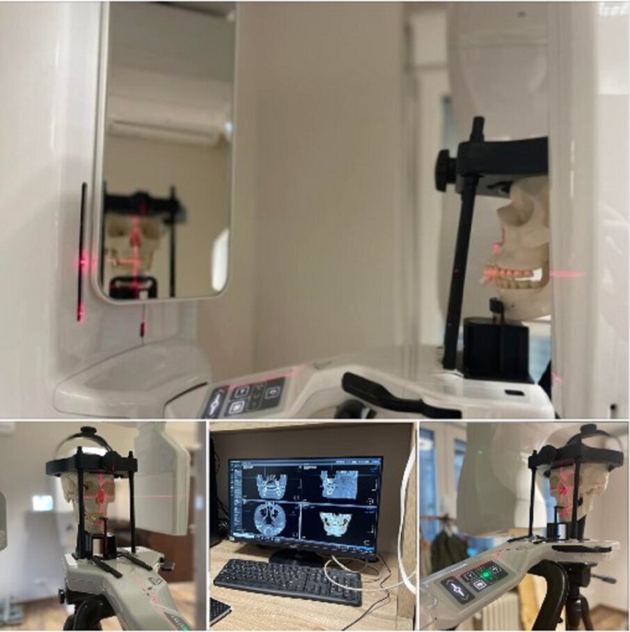 sl.2 i sl.3. Obuke na svim dentalnim radiološkim modalitetima snimanja (2D intraoralno i ekstraoralno, 3D CBCT)