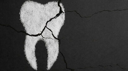 Report sheds light on dental service in Northern Ireland since onset of pandemic