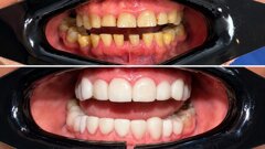 El paciente quería una sonrisa, pero el diagnóstico reveló algo más