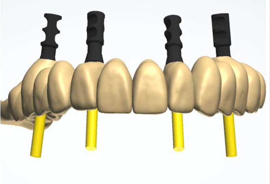 Fig. 26