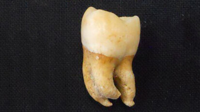 Researchers develop new method to determine biological sex of human skeletal remains