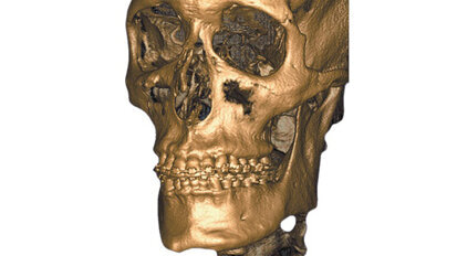 CBCT-Webinar: Voordelen van 3D Imaging integratie in uw praktijk