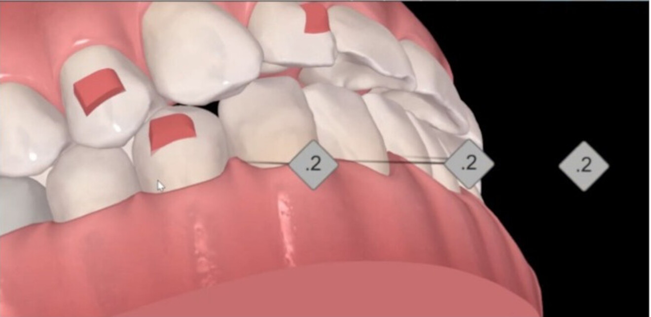 Fig. 2b