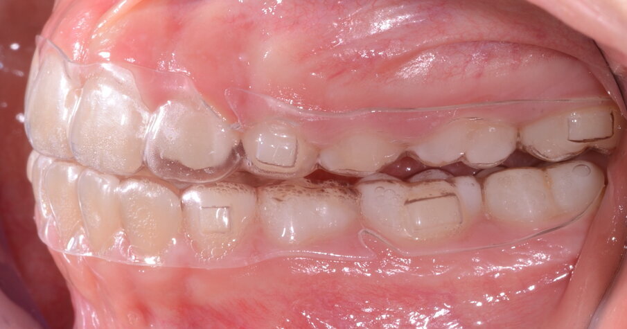 Fig. 4b.