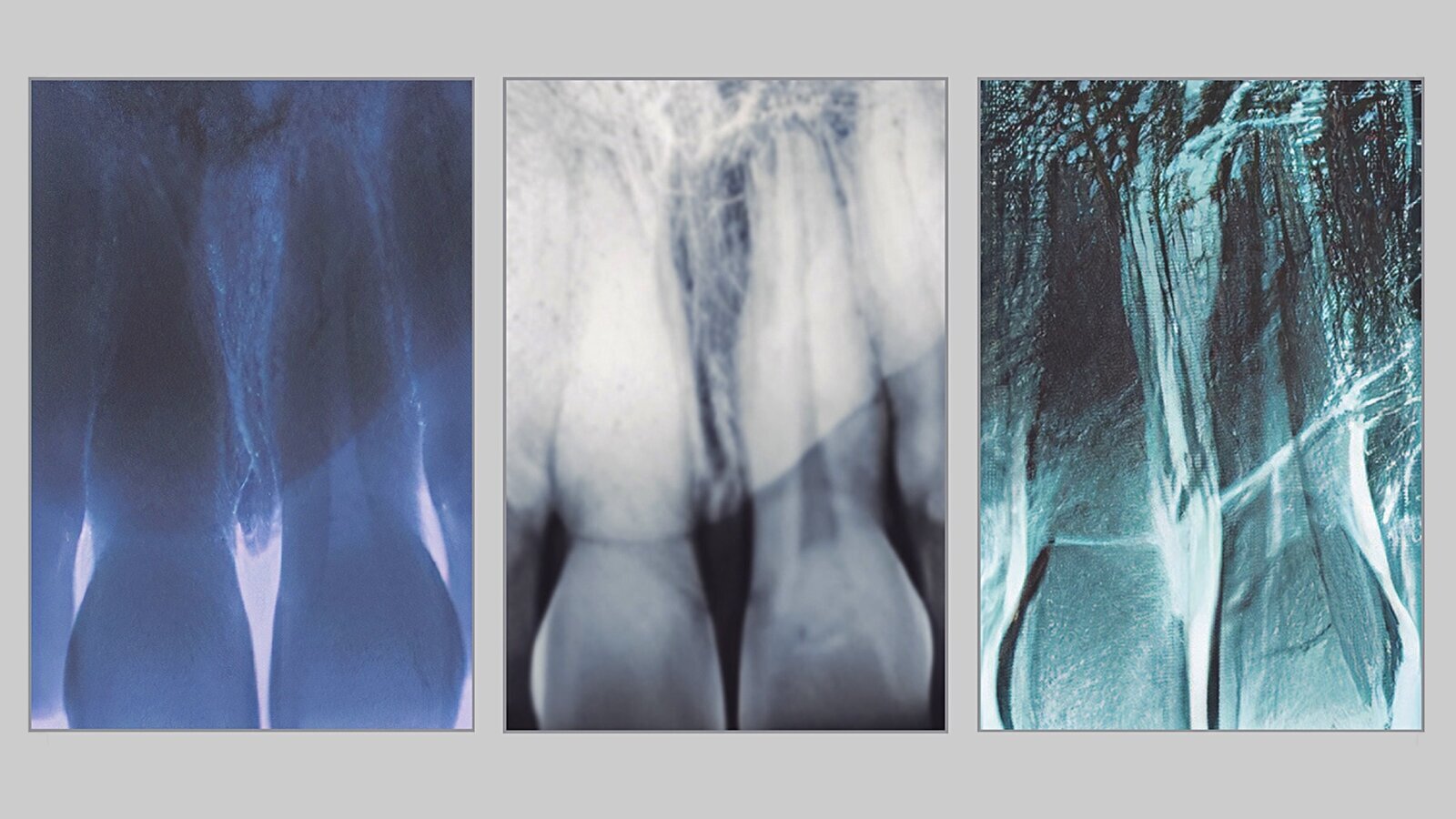 Estética y blanqueamiento dental en la era digital  (Capítulo 8)