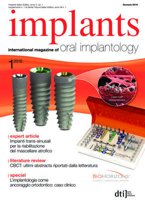 implants Italy No. 1, 2016