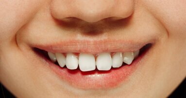 IX Międzynarodowa Konferencja Naukowo-Szkoleniowa Lekarzy Dentystów „Między funkcją a estetyką”