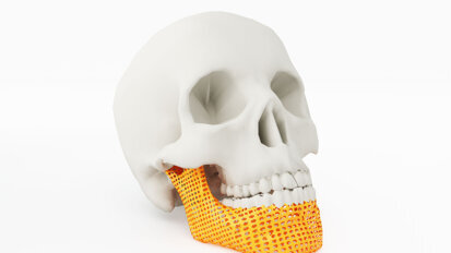 Đánh giá toàn diện mới về in 3D trong phẫu thuật miệng và hàm mặt