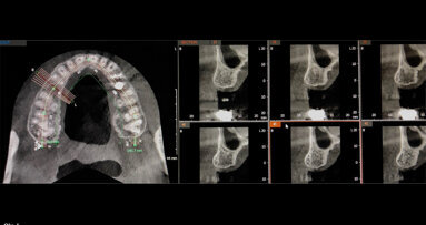 JMDC organises special session on CBCT