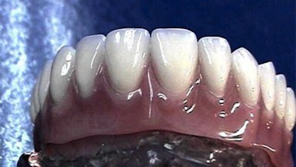 Economizando en la compra de materiales dentales