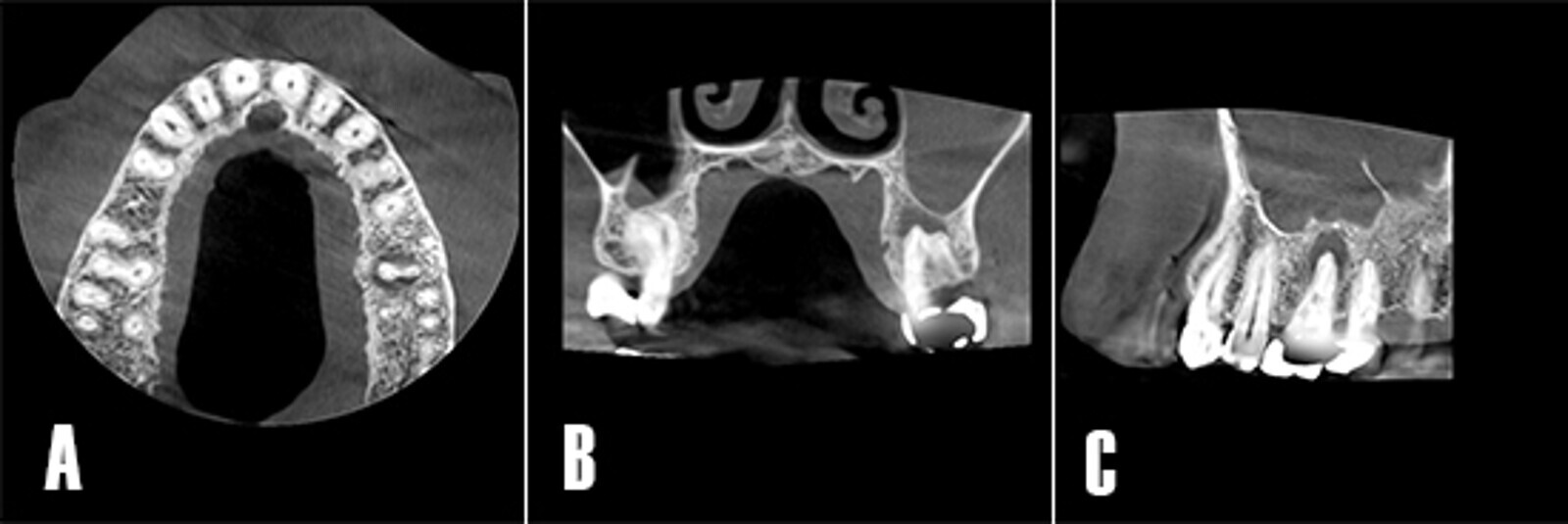 Fig3