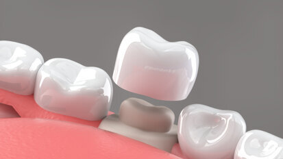 Bredent announces hands on implant workshops
