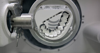 Elevate estetica e funzione con lo zirconio integrale altamente traslucente Ceramill Zolid
