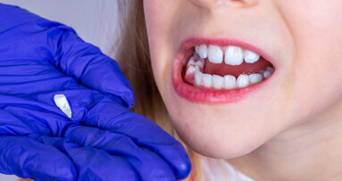 Growth lines of primary teeth may help evaluate risk of developing mental disorders