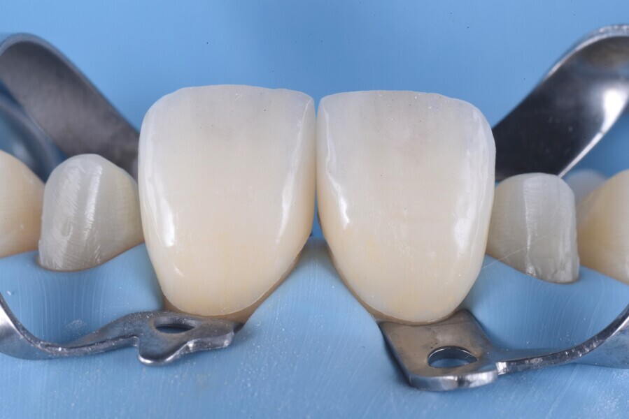 Fig. 15b.