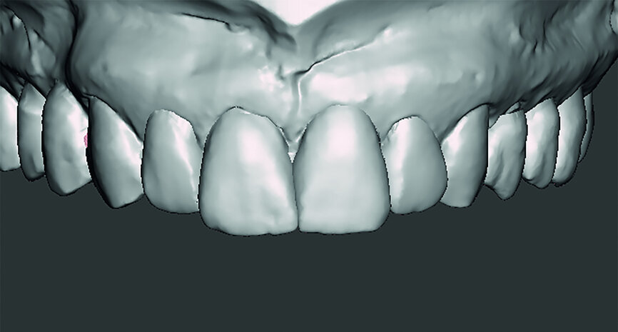 Fig. 10h
