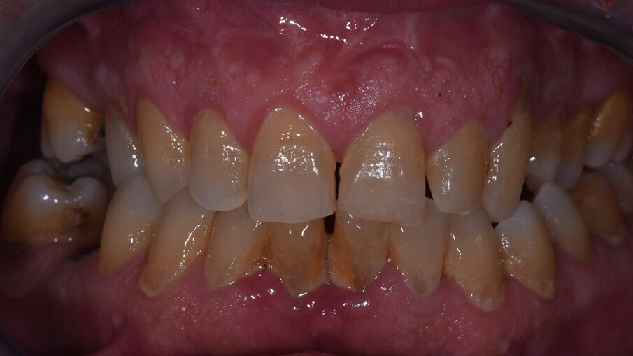Fig. 1a