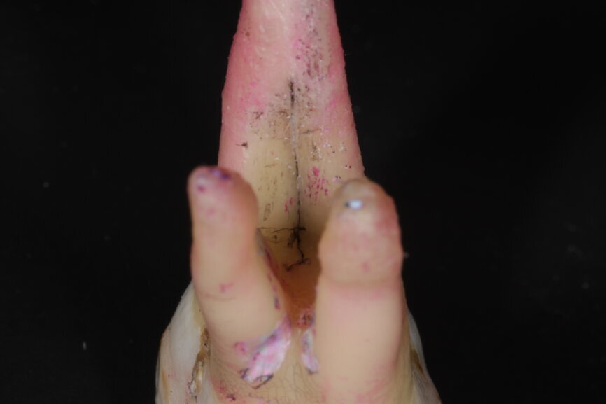 Fig. 4