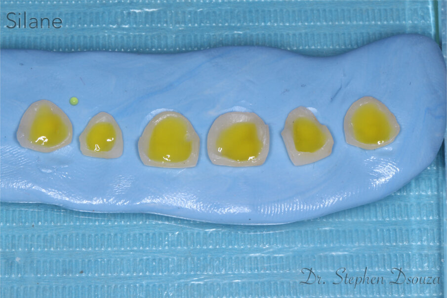 Fig. 14: Silane application.