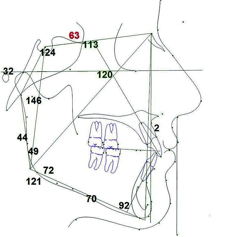 Fig. 52