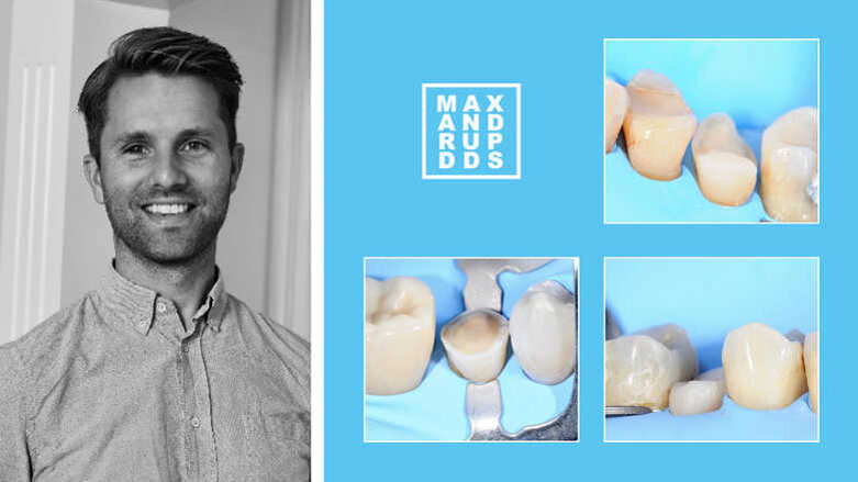 Entrevista: “Tudo começa com o agente adesivo de dentina certo”