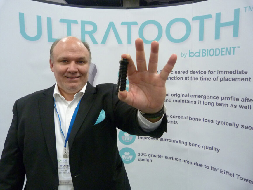 Michael Polley of Biodent displays an oversized model of the company’s innovative ‘one-visit, one-hour’ tooth replacement system. (Photo: Robert Selleck/DTA)