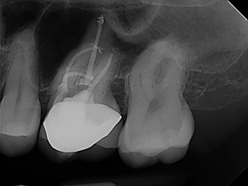 Fig.: 3