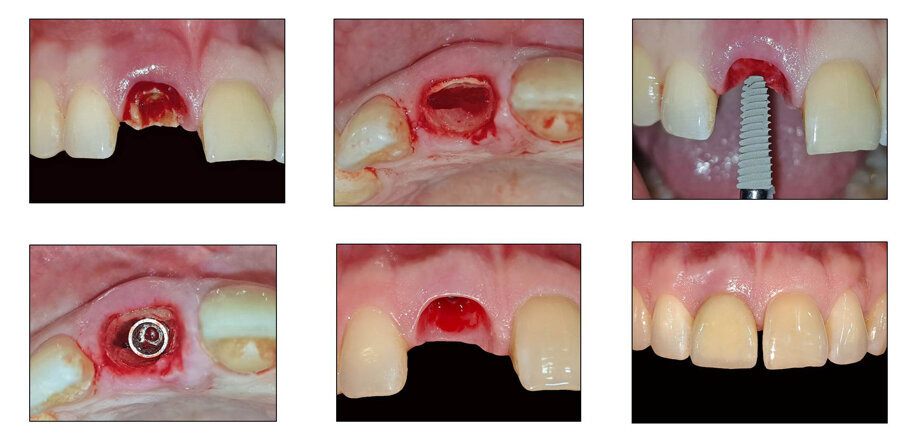 Fig 59