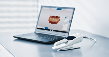 Dentsply Sirona extends its digital universe with Primescan Connect
