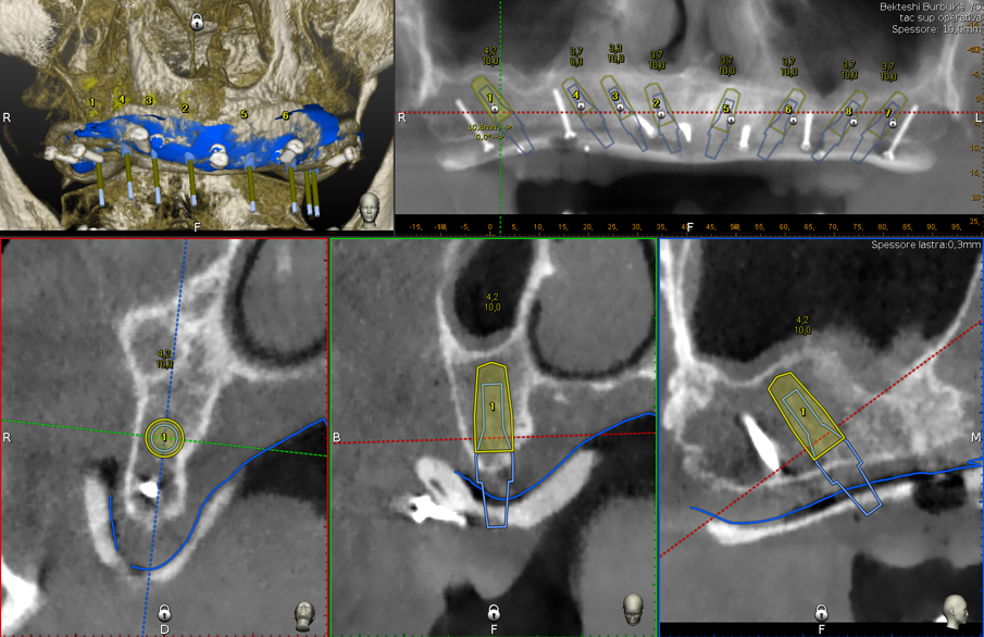 Fig. 2